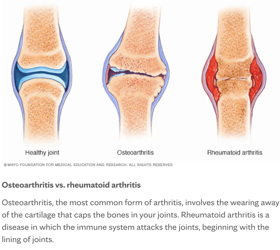 Anthritis